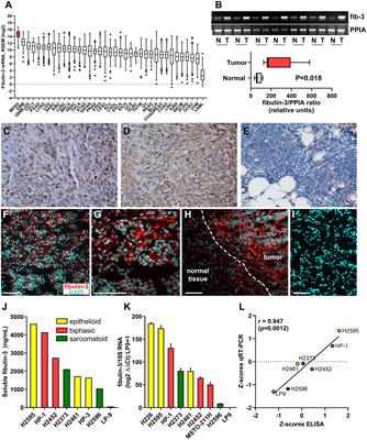 The extracellular matrix protein fibulin-3/EFEMP1 promotes pleural mesothelioma growth by activation of PI3K/Akt signaling